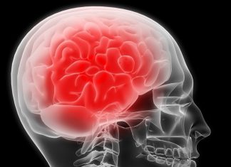 Aumenta número de casos de meningite no Espírito Santo em 2017